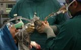 انجام پیچیده‌ترین جراحی تومور مغزی کشور برای اولین بار در یزد